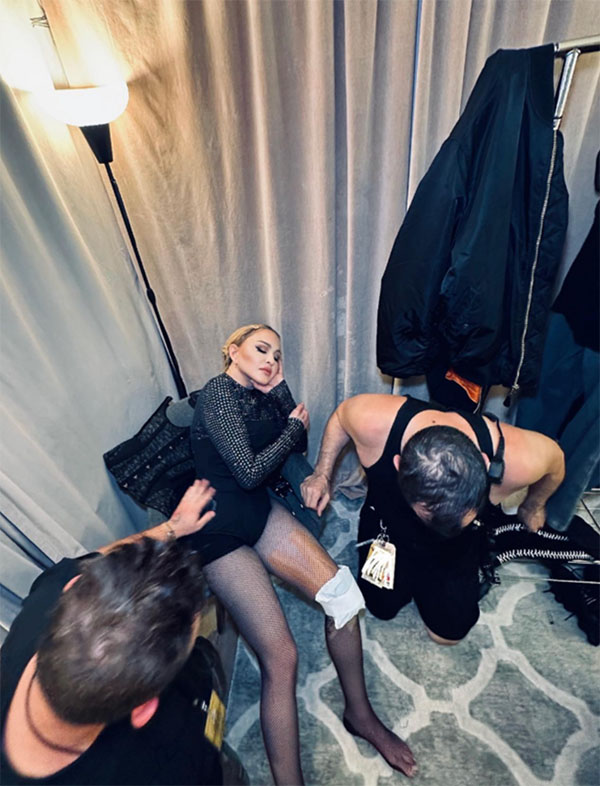 Madonna gets an ice pack on her knee after tour rehearsals